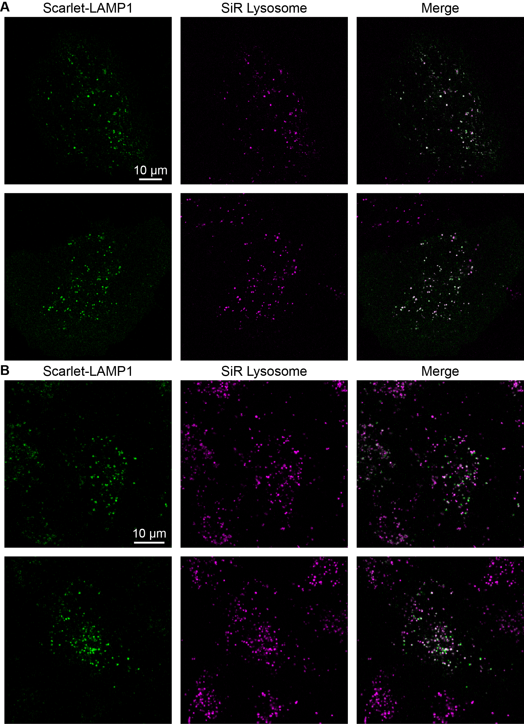 Colocalization with SiR Lysosome